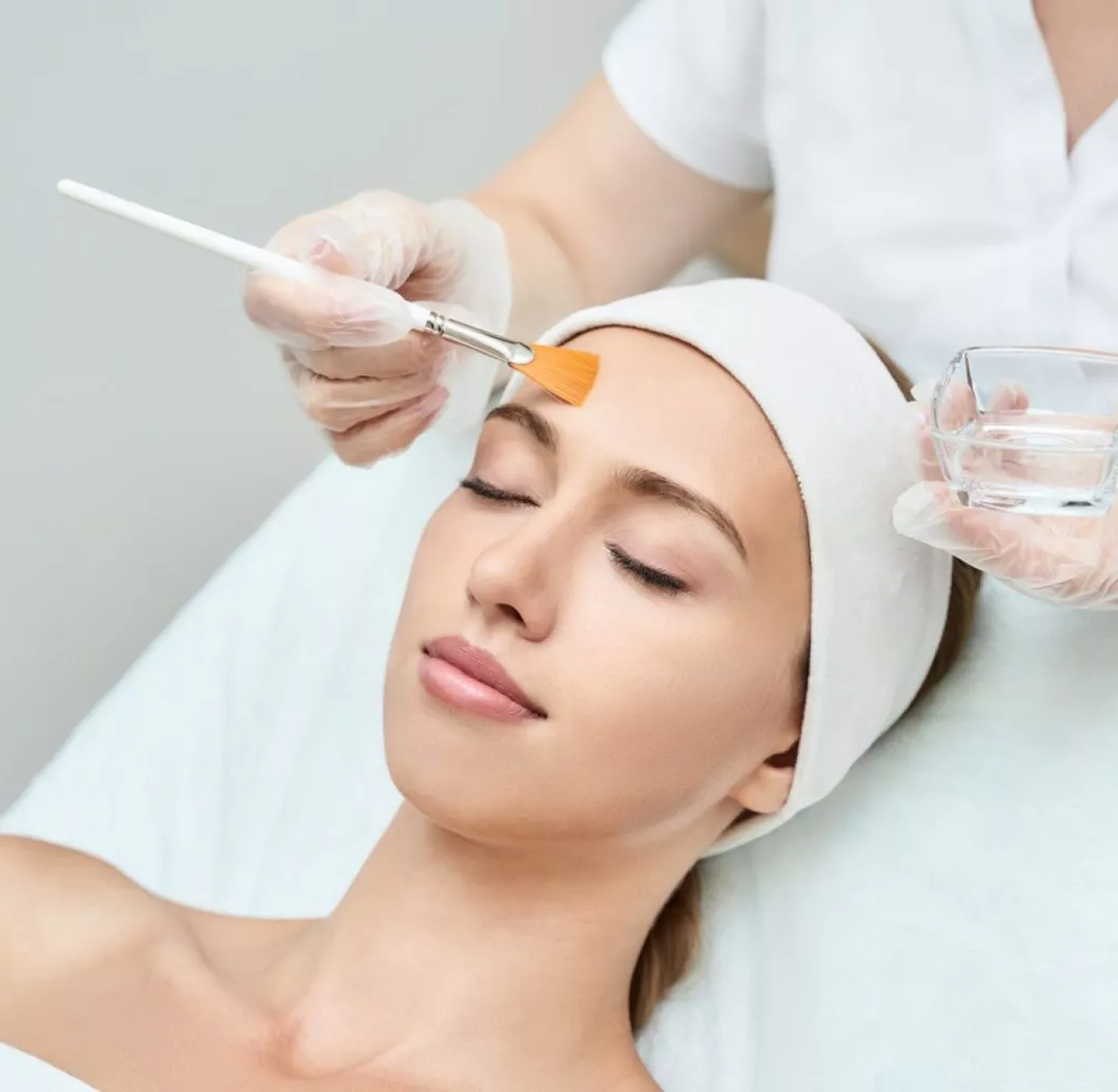 Chemical Peel
